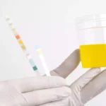 Combien de temps le CBD reste t-il détectable dans les urines ?