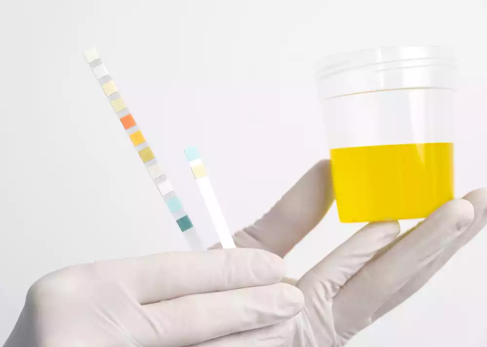 Combien de temps le CBD reste t-il détectable dans les urines ?